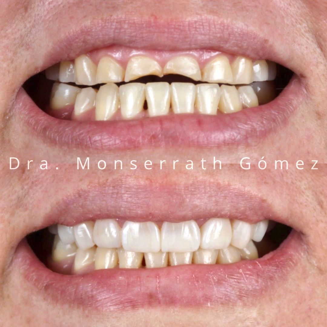 Monserrath Gomez Mendez-4