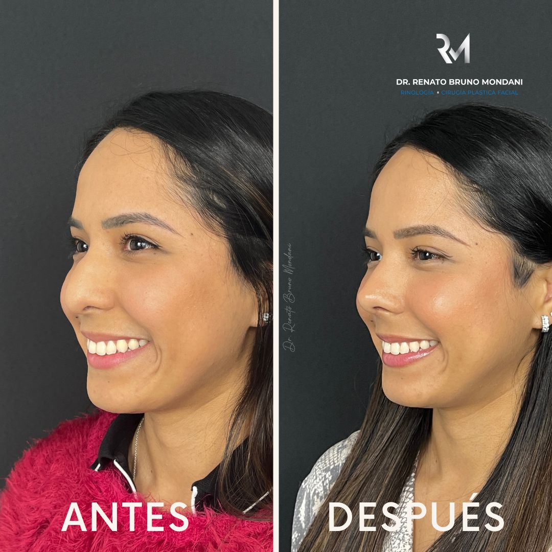 Renato Bruno Mondani-6