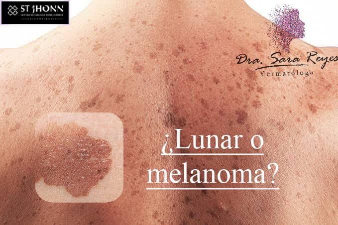 Sara Reyes Orozco-20