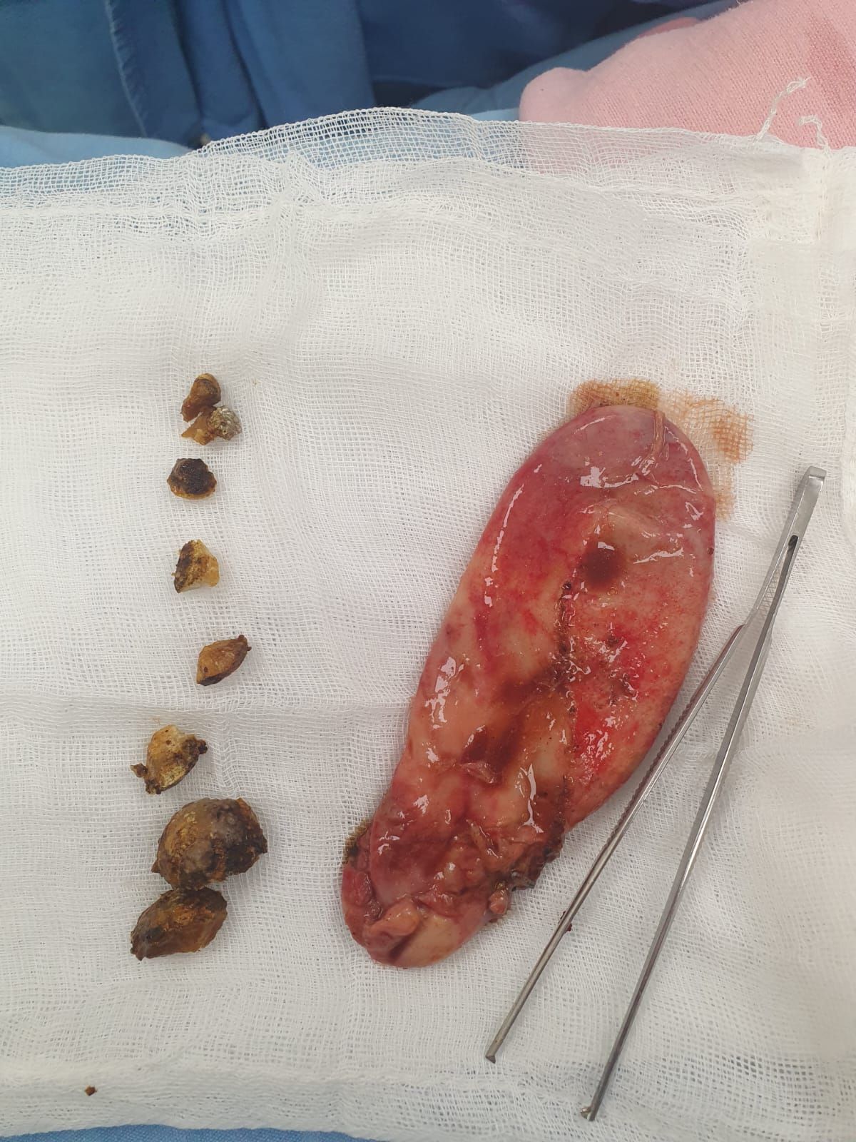 Marco Antonio Cantu Flores-4