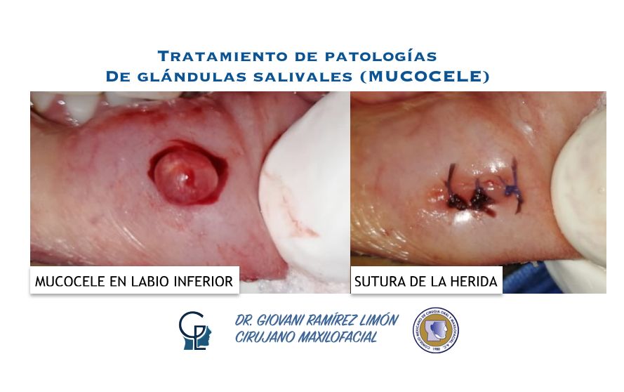 Giovani Ramírez Limón-34