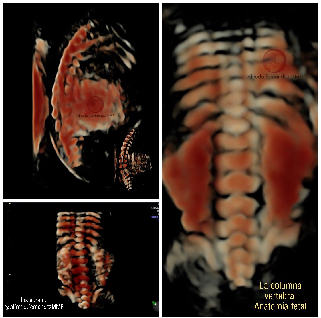 Alfredo Fernández-3