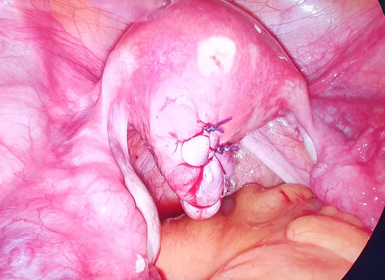 Martha Helena Cabezas Pérez-14