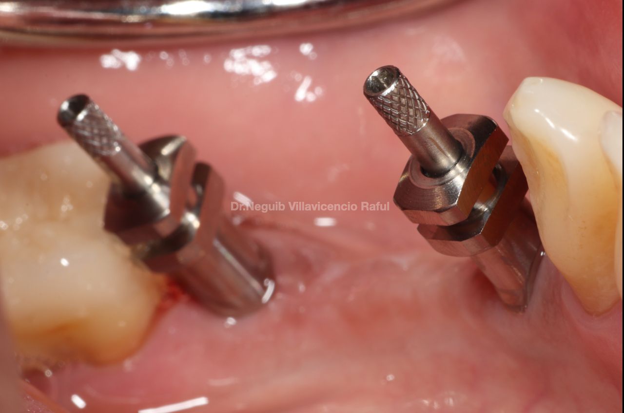 Neguib Villavicencio Raful-45