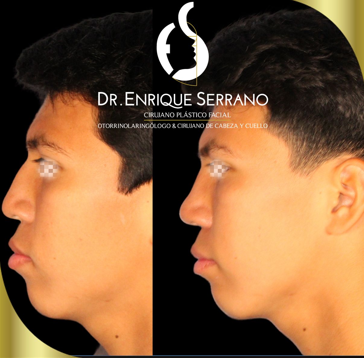 Enrique Serrano Cruz-14