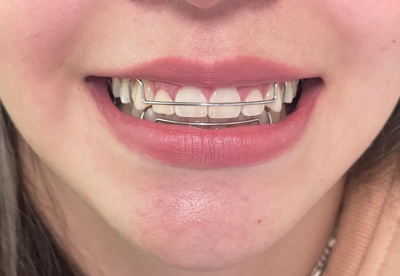 Anuar Becerril Castro-6