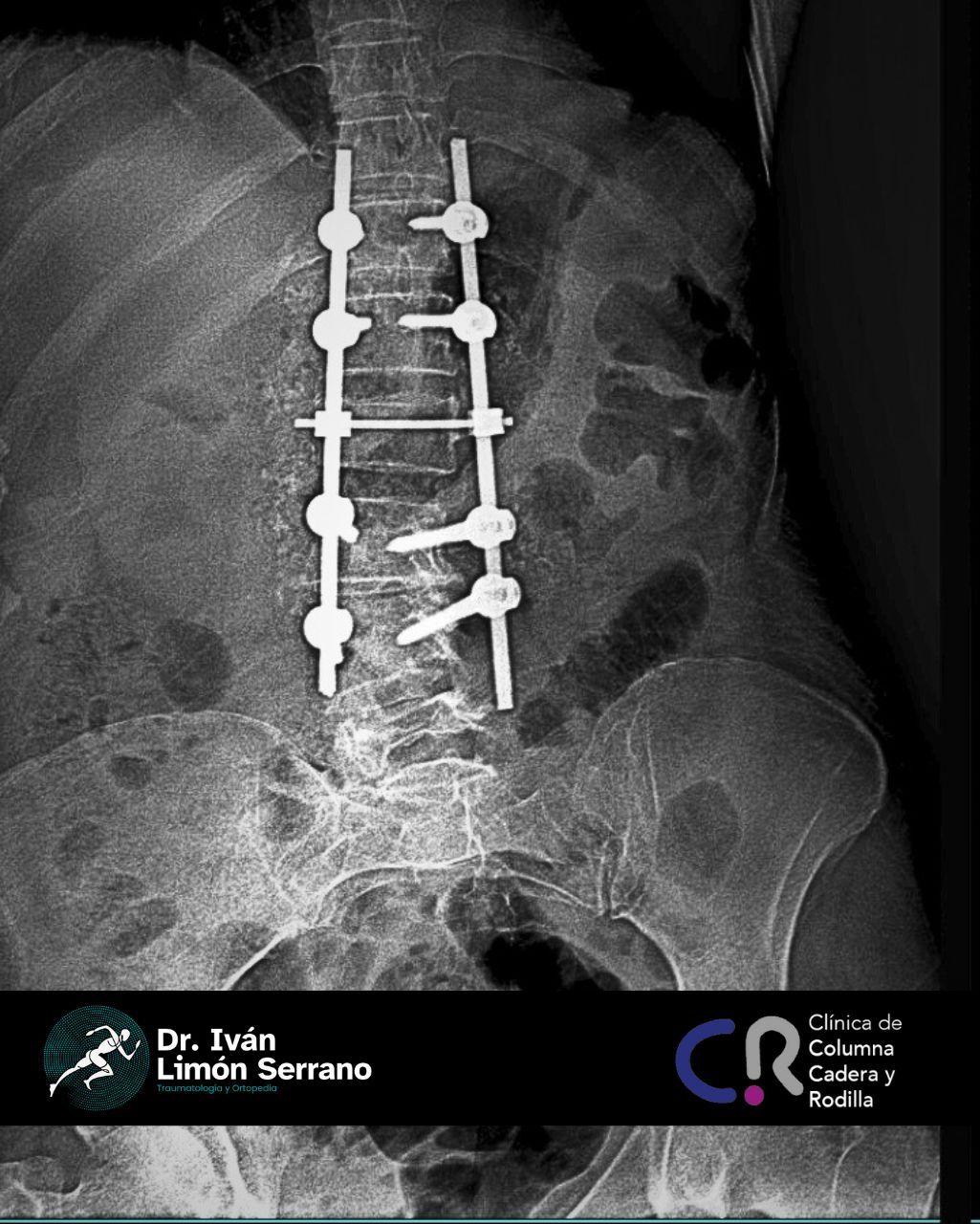 Iván Limón Serrano-29