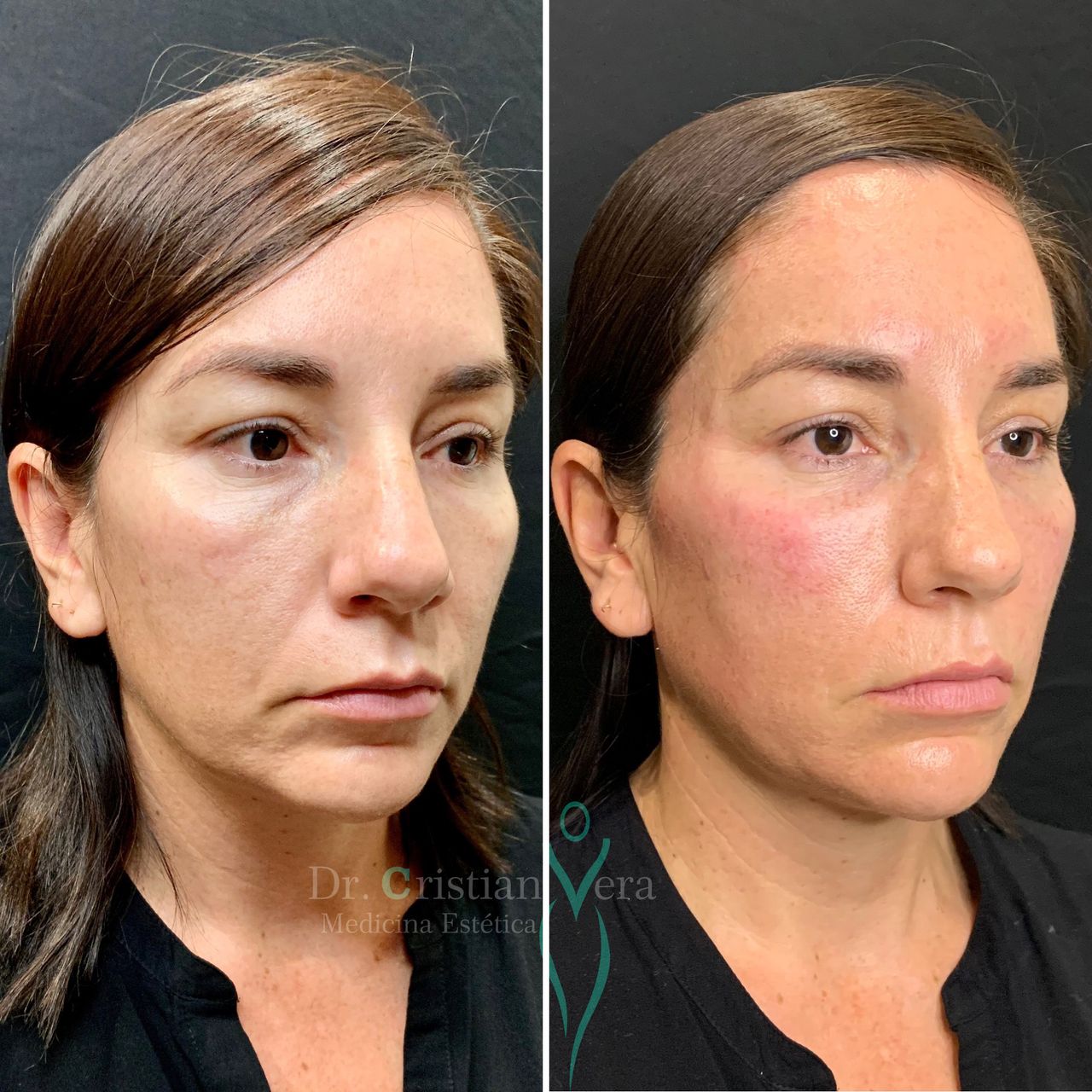 Cristian Eduardo Vera Nuño-10