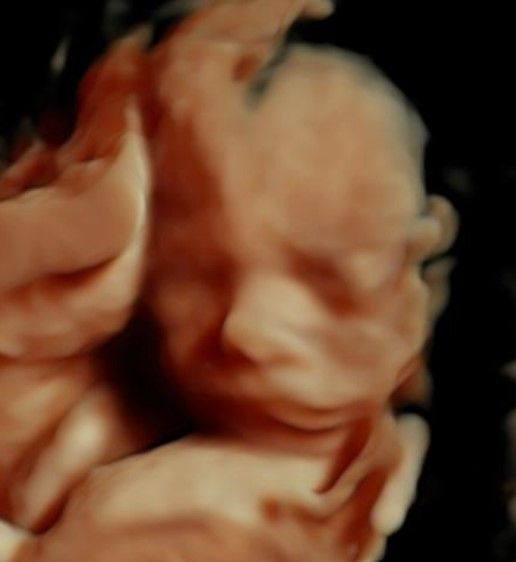 Irlanda Ayala Díaz-2