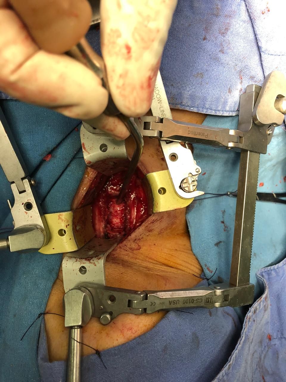 Juan José Luévano De La Cruz-9