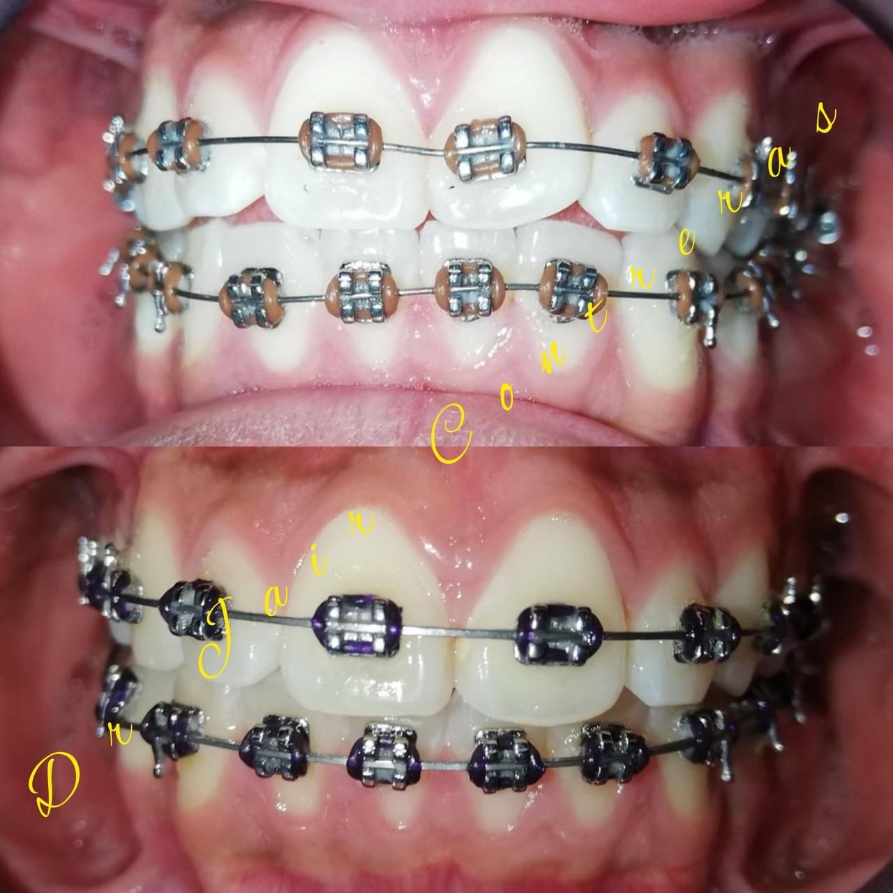 Jair Contreras García-14
