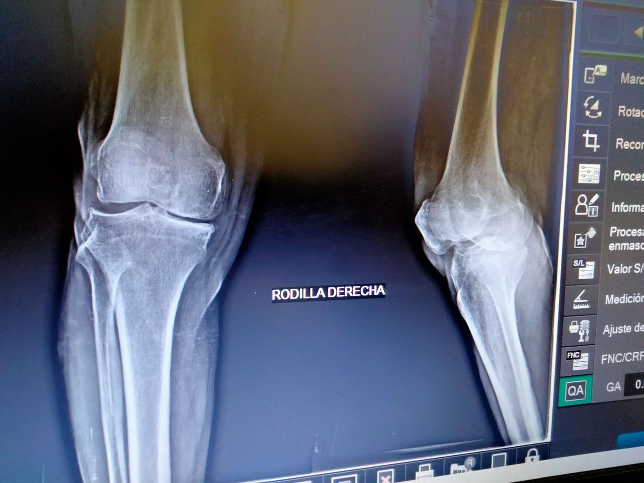 Carlos Horacio Sanchez Rodrigo-19