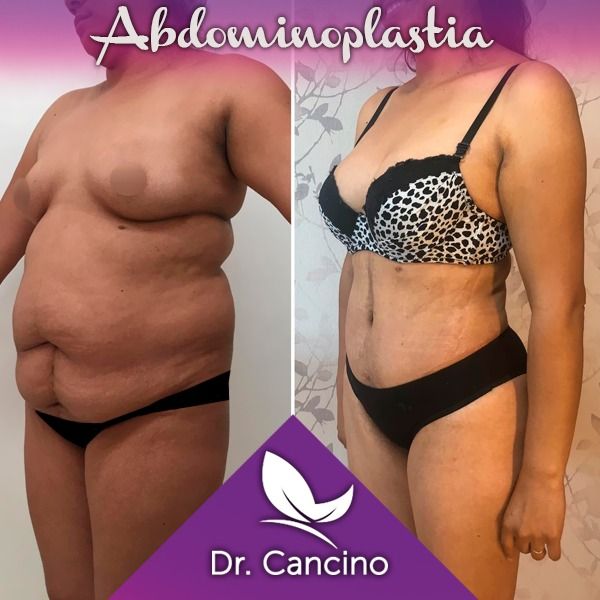 Luis M. R. Cancino-35