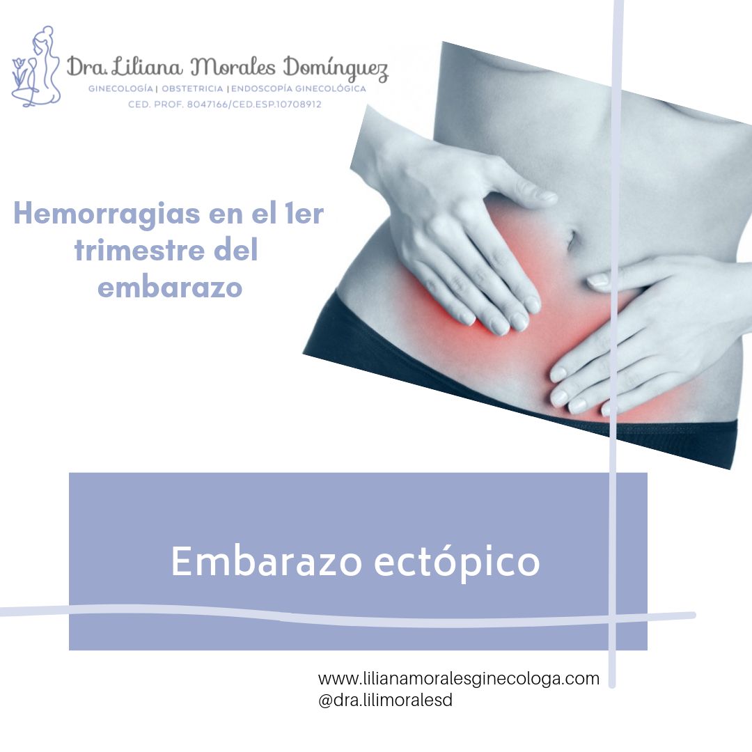 Liliana Morales Domínguez-7