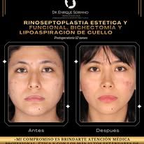 Enrique Serrano Cruz-17