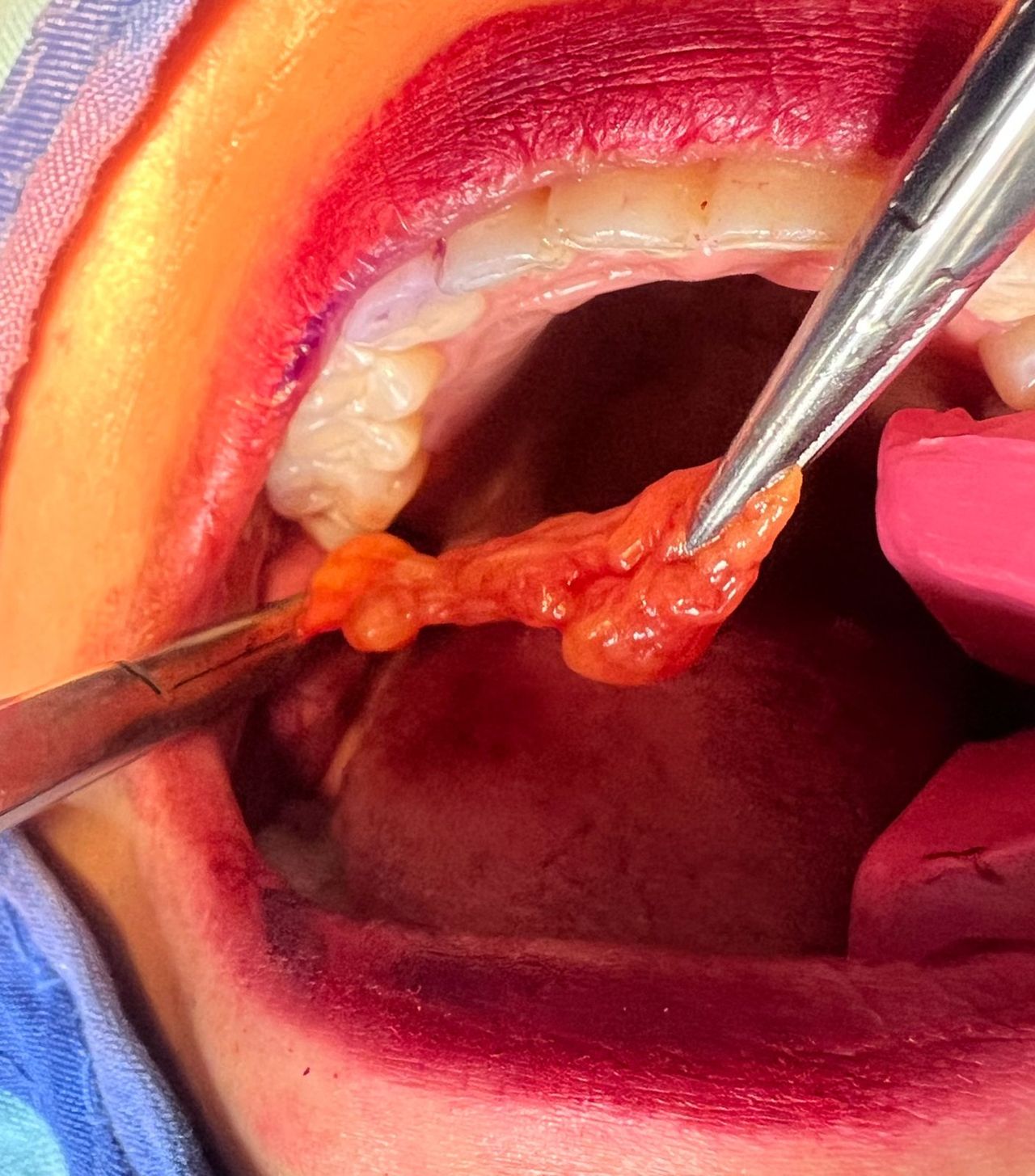 Jair Contreras García-4