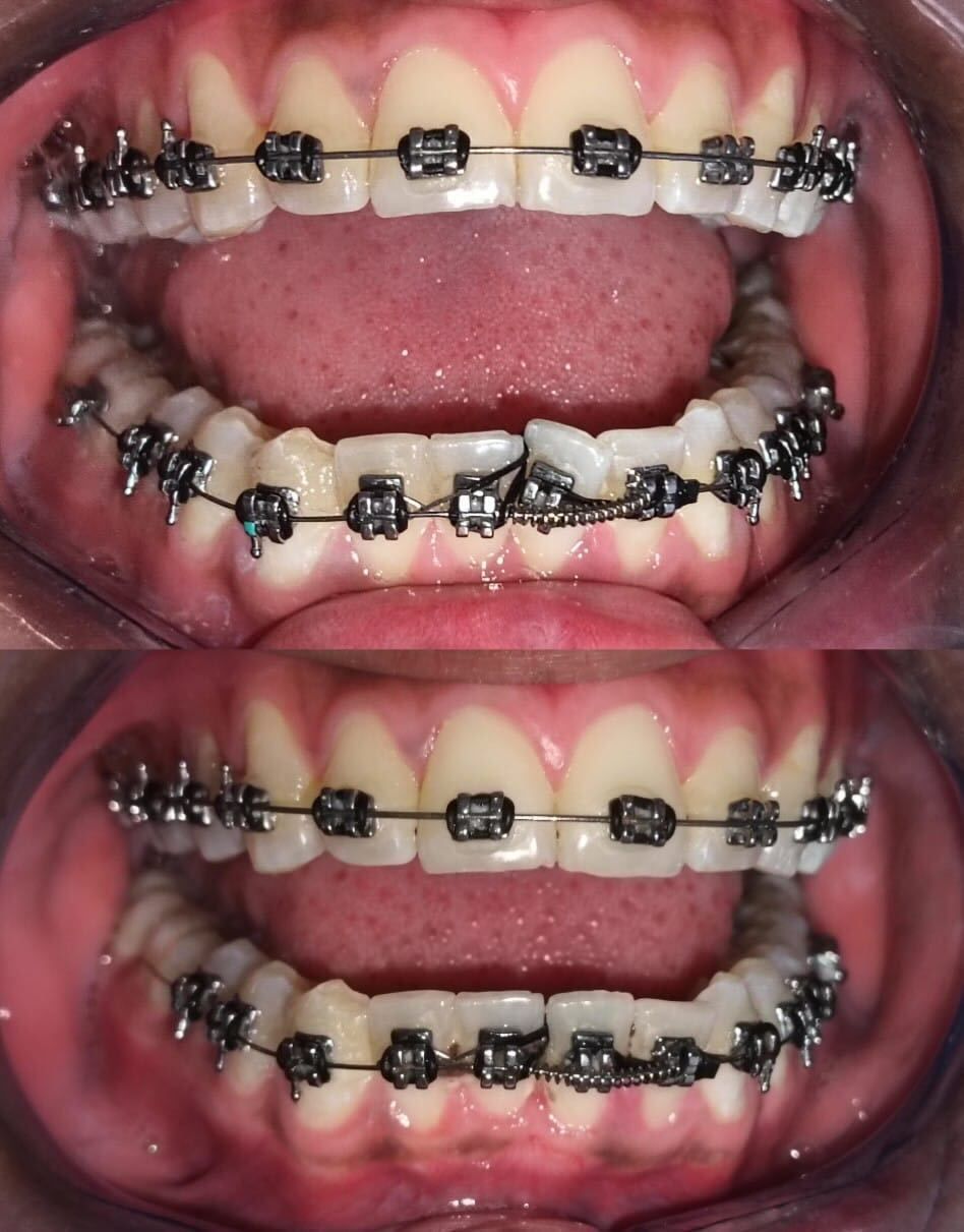 Luz Anel Valente Lozano-10