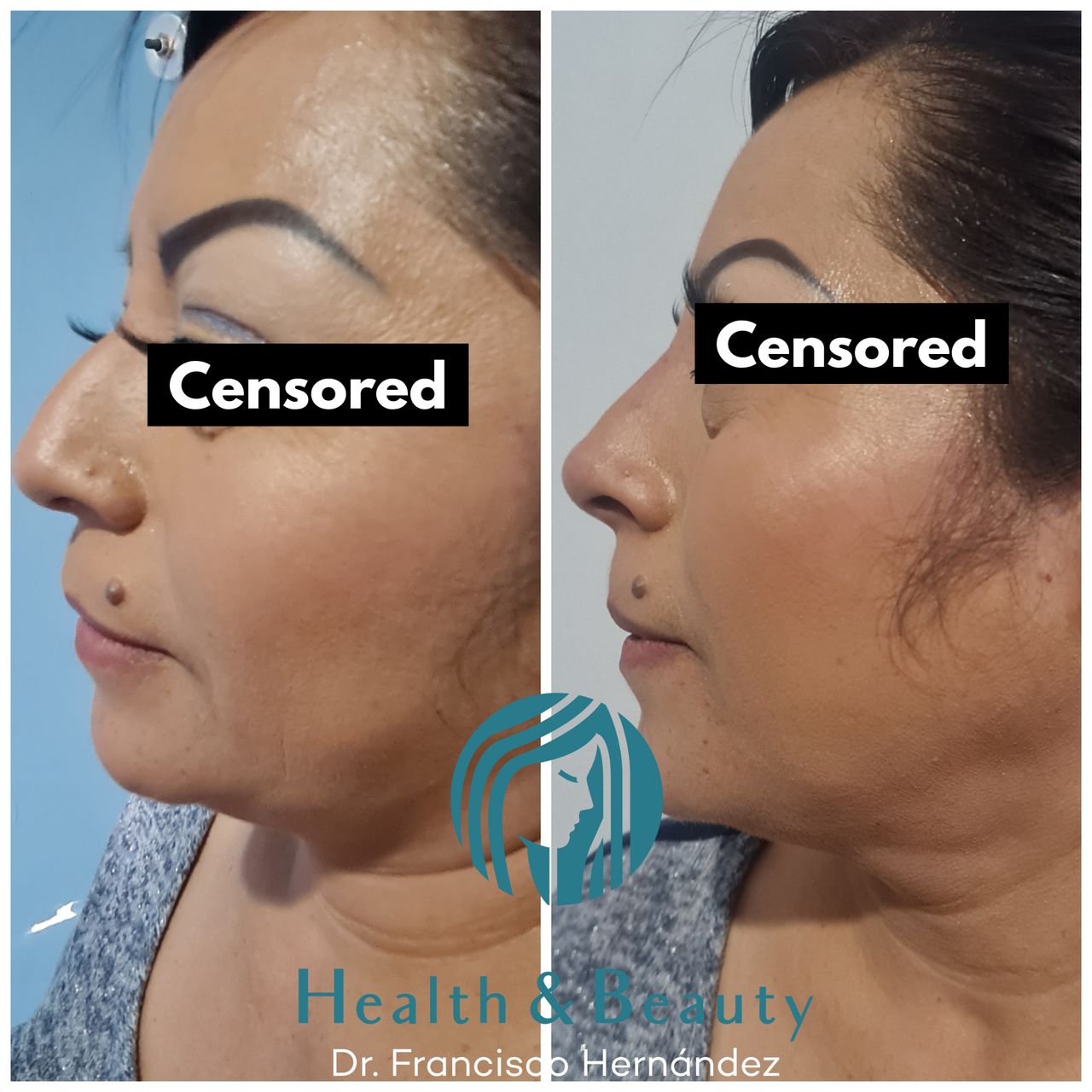 Francisco Hernández Gómez Crespo-79