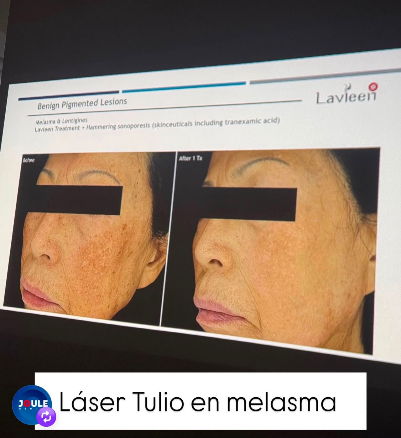Lourdes Mena-11