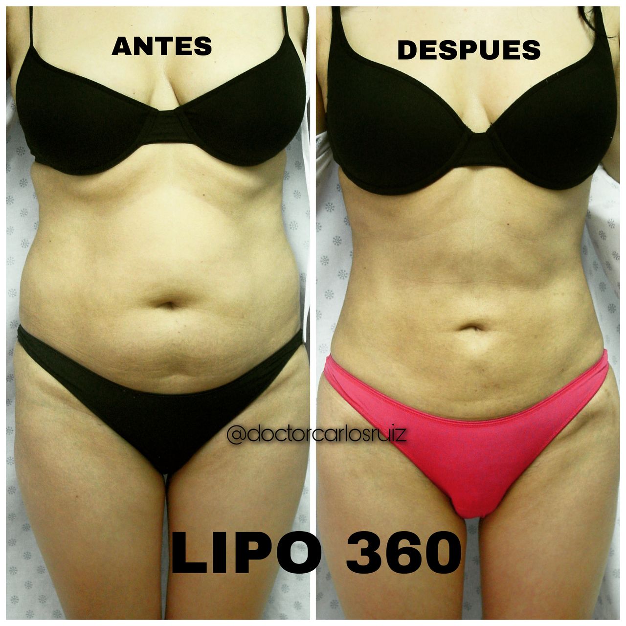 Carlos Alberto Ruiz Zepeda-14