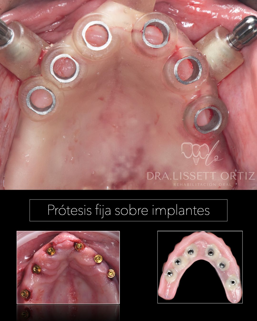 Ana Lissett Ortiz-30