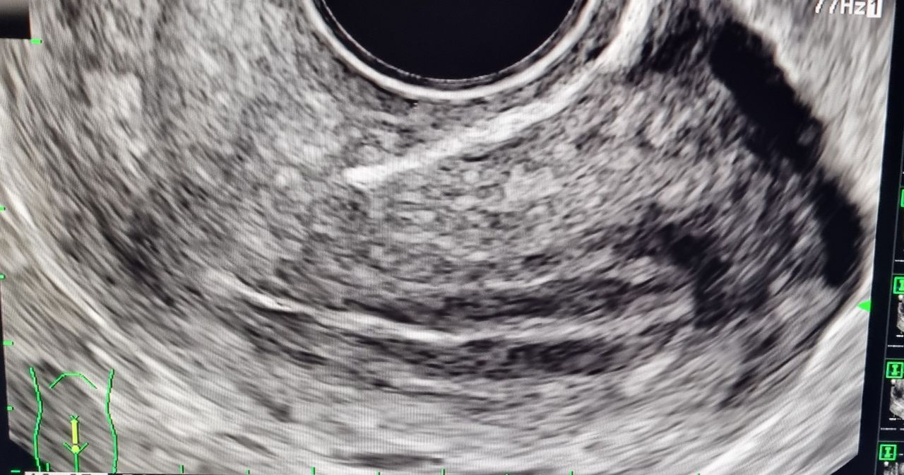 Ramón  Pascacio Pérez -2