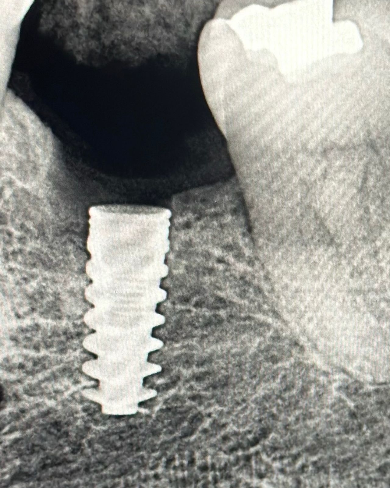 Ruben Arrieta Perez-2