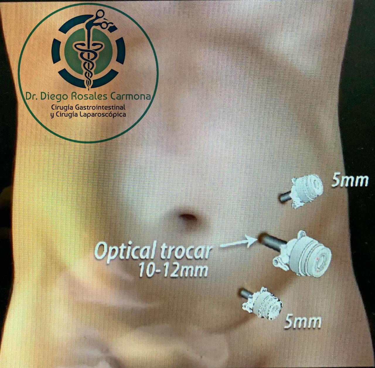 Diego Edwuin Rosales Carmona-9