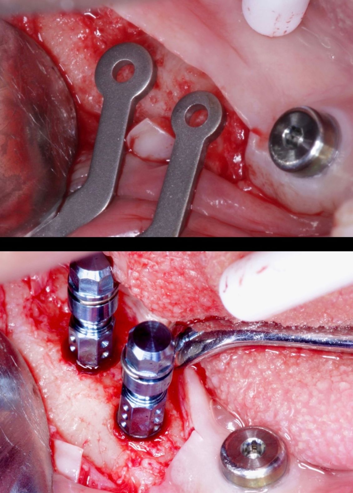 Josué Márquez Gómez-76