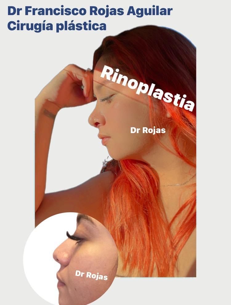 Francisco Rojas Aguilar-4