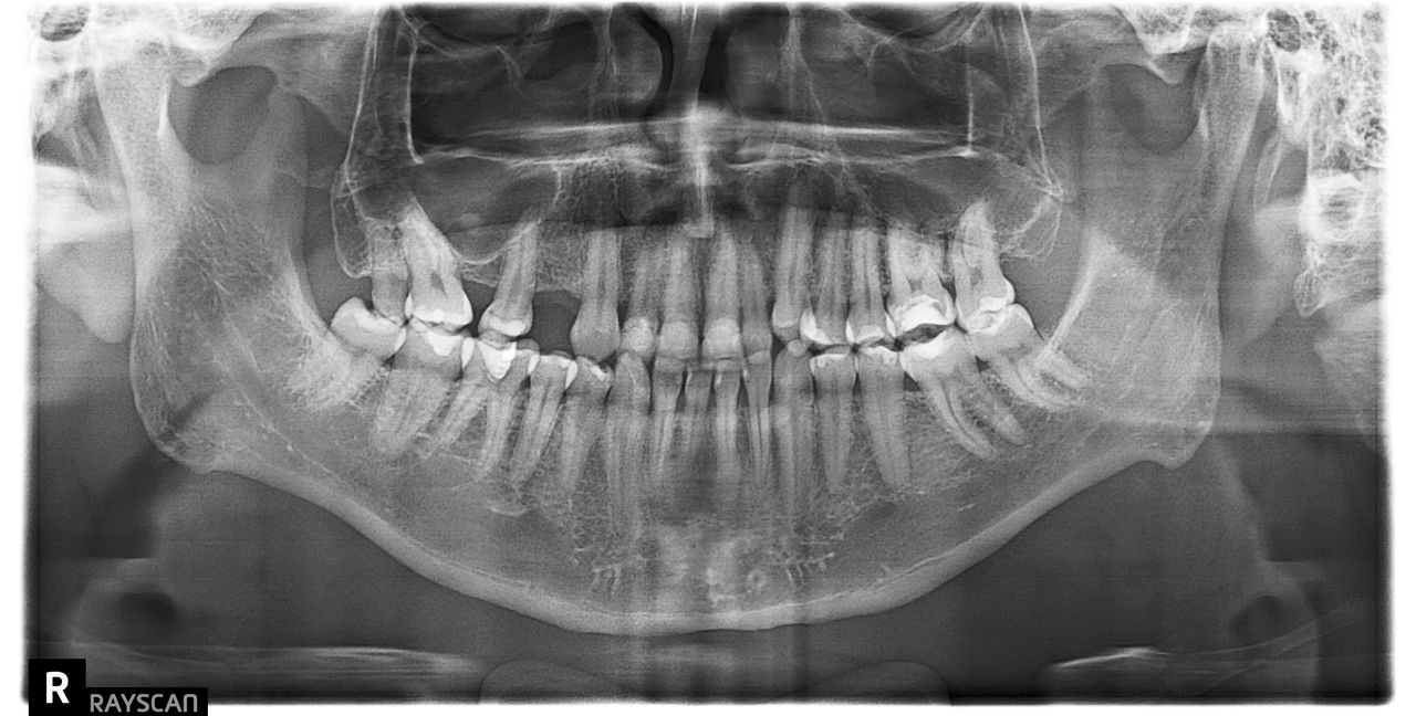 Marco Tulio Alzaga Vega-0