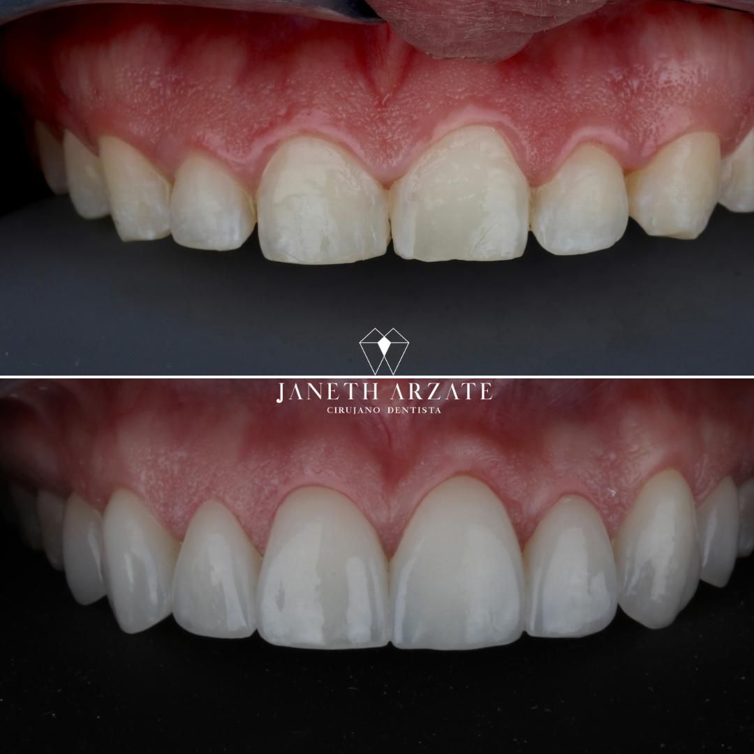 Janeth Arzate Banda-12