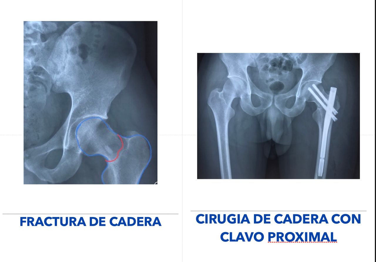 Pablo Mendoza Becerril-3