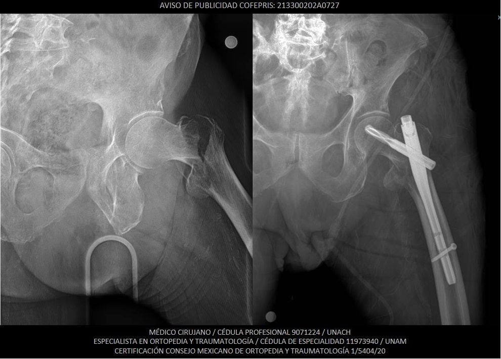 Luis Castañón Robles-14