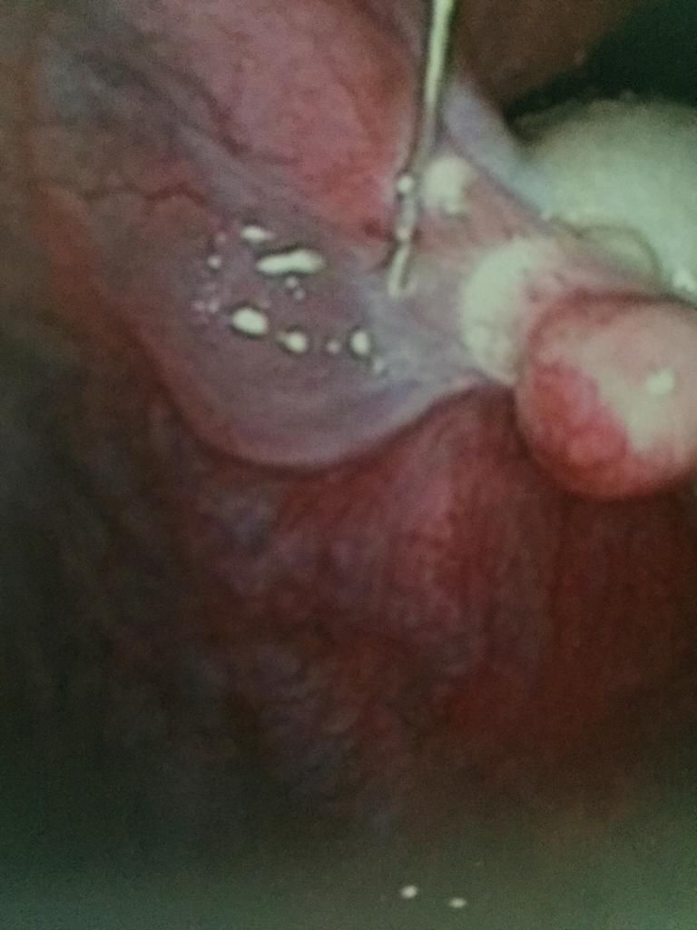 Alfredo Mendez Samano-13