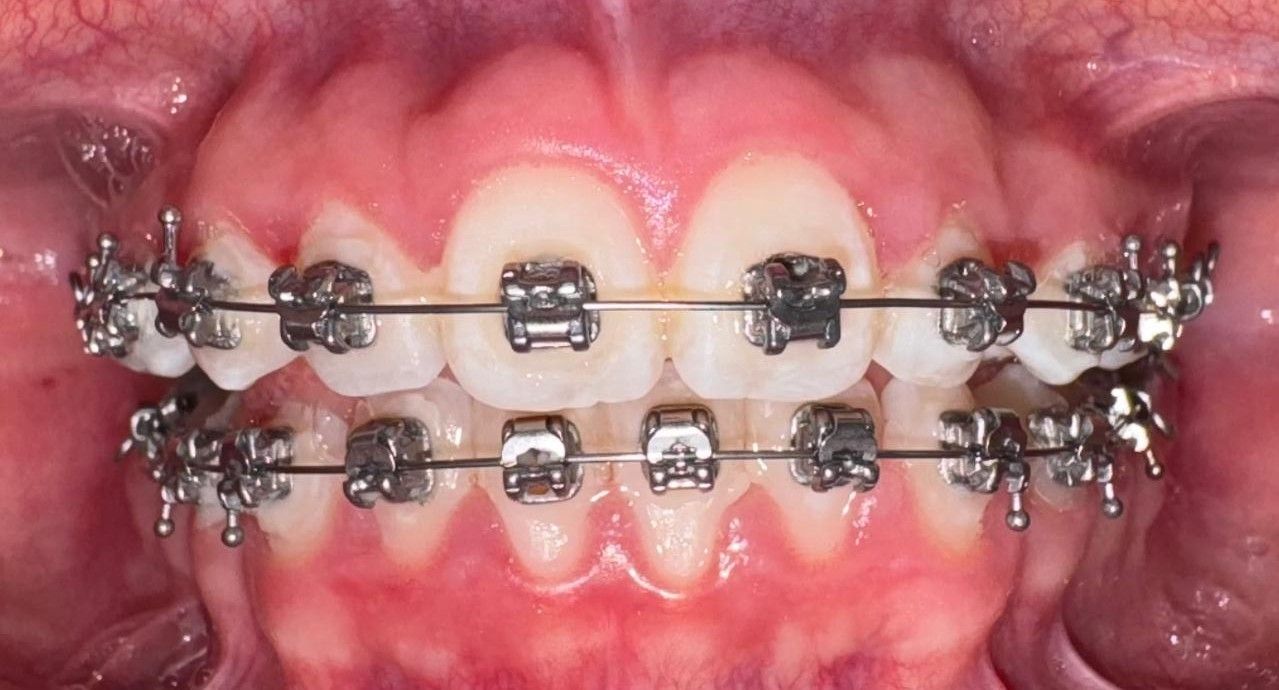 Miguel Angel Garita Cruz-7