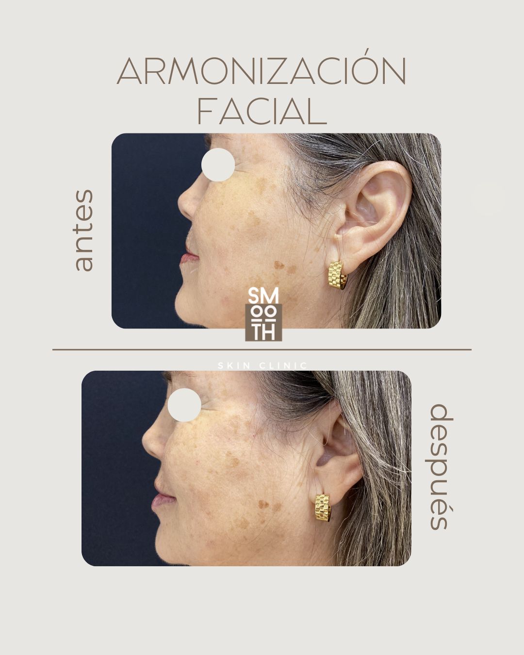 Samantha Martínez-98