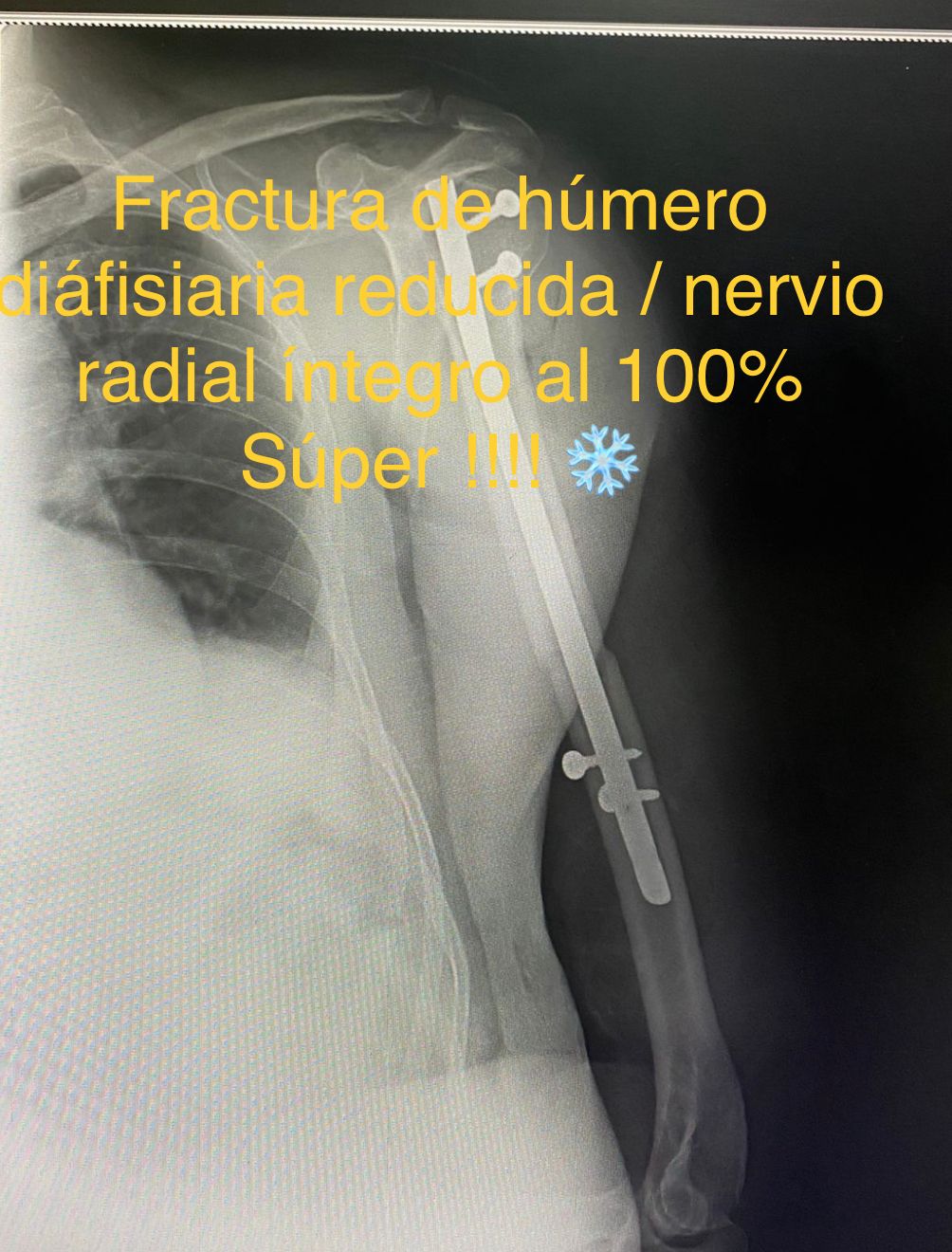 Emmanuel Bolaños Cortes-20