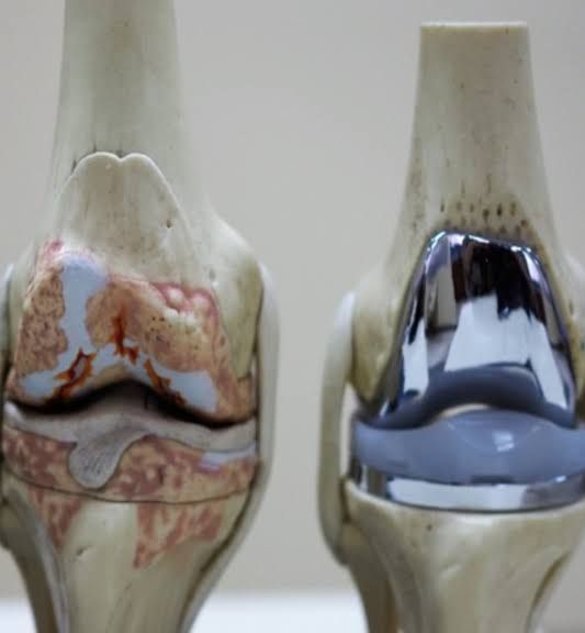 Giovanny Santander Becerra-43