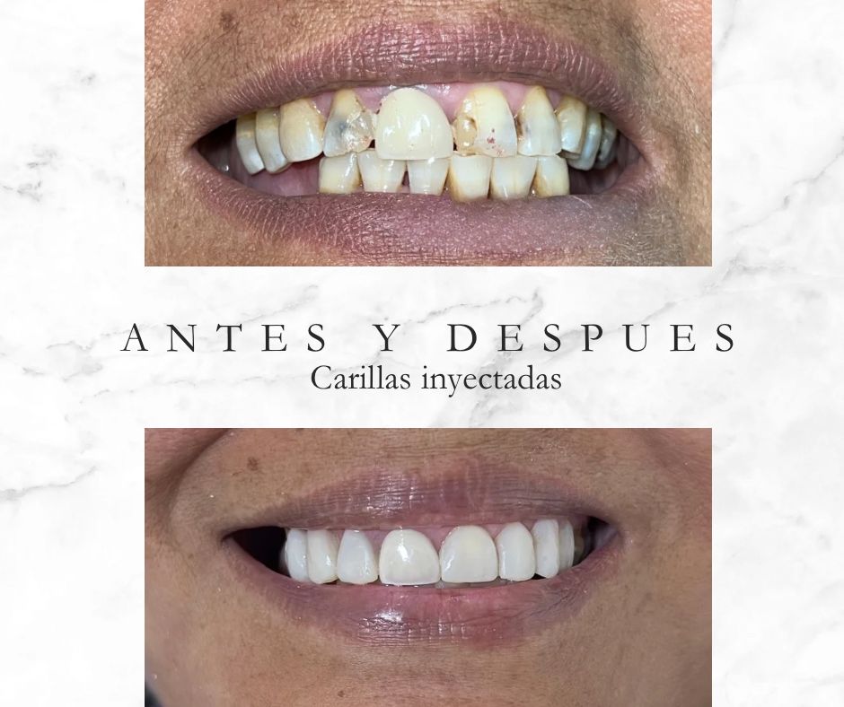 Noe Arturo Cortazar Sánchez-6