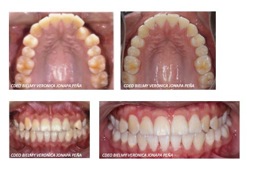 Bielmy Veronica Jonapa Peña-6