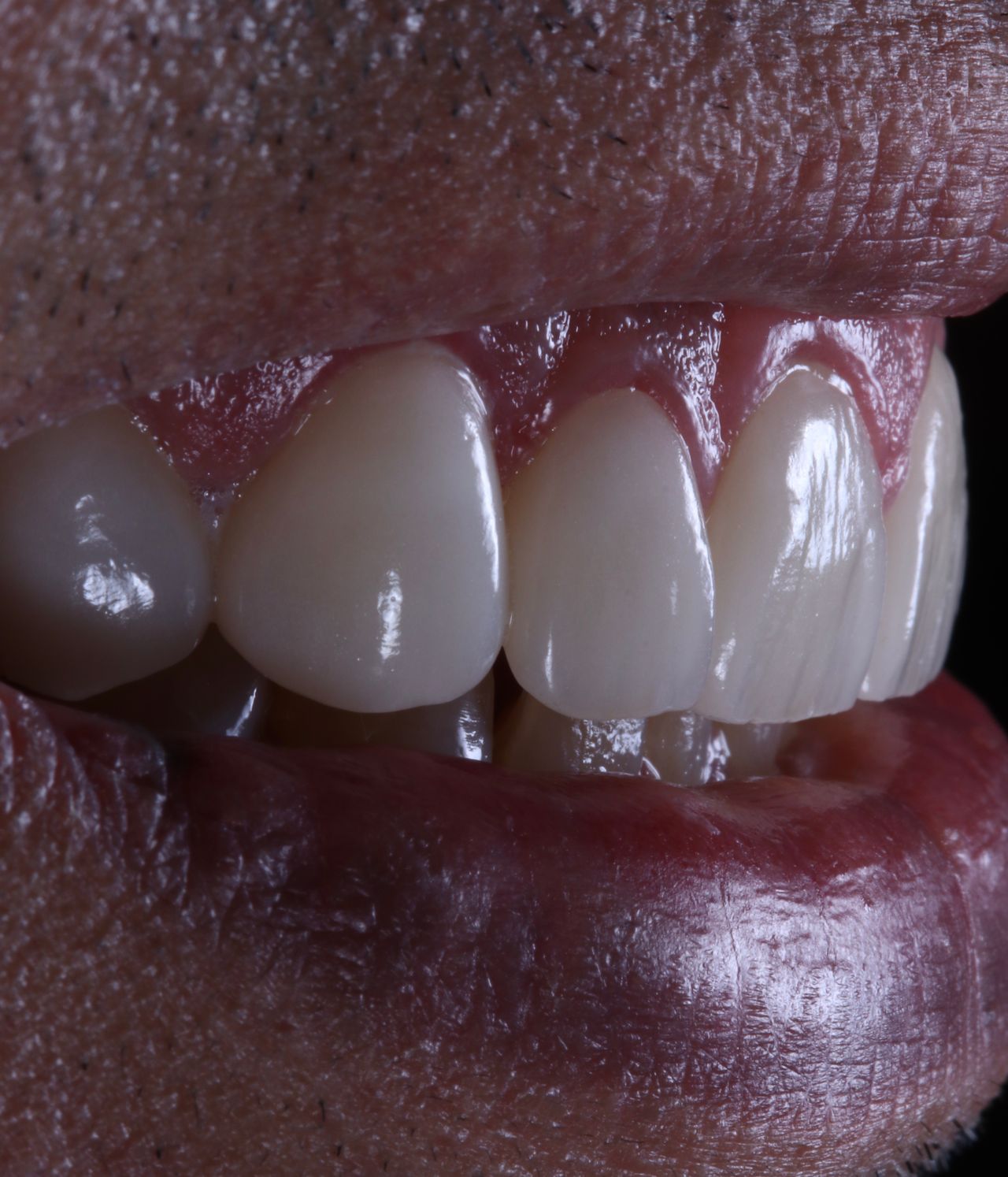 Ernesto Rojas Calderon-32