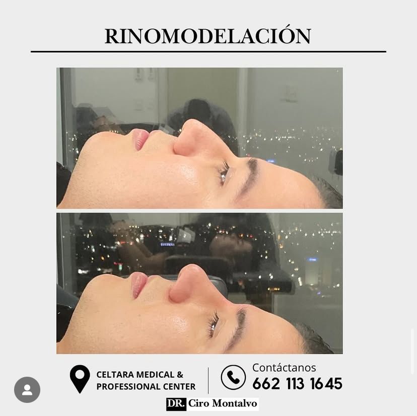 Ciro Alberto Montalvo Bojorquez-5