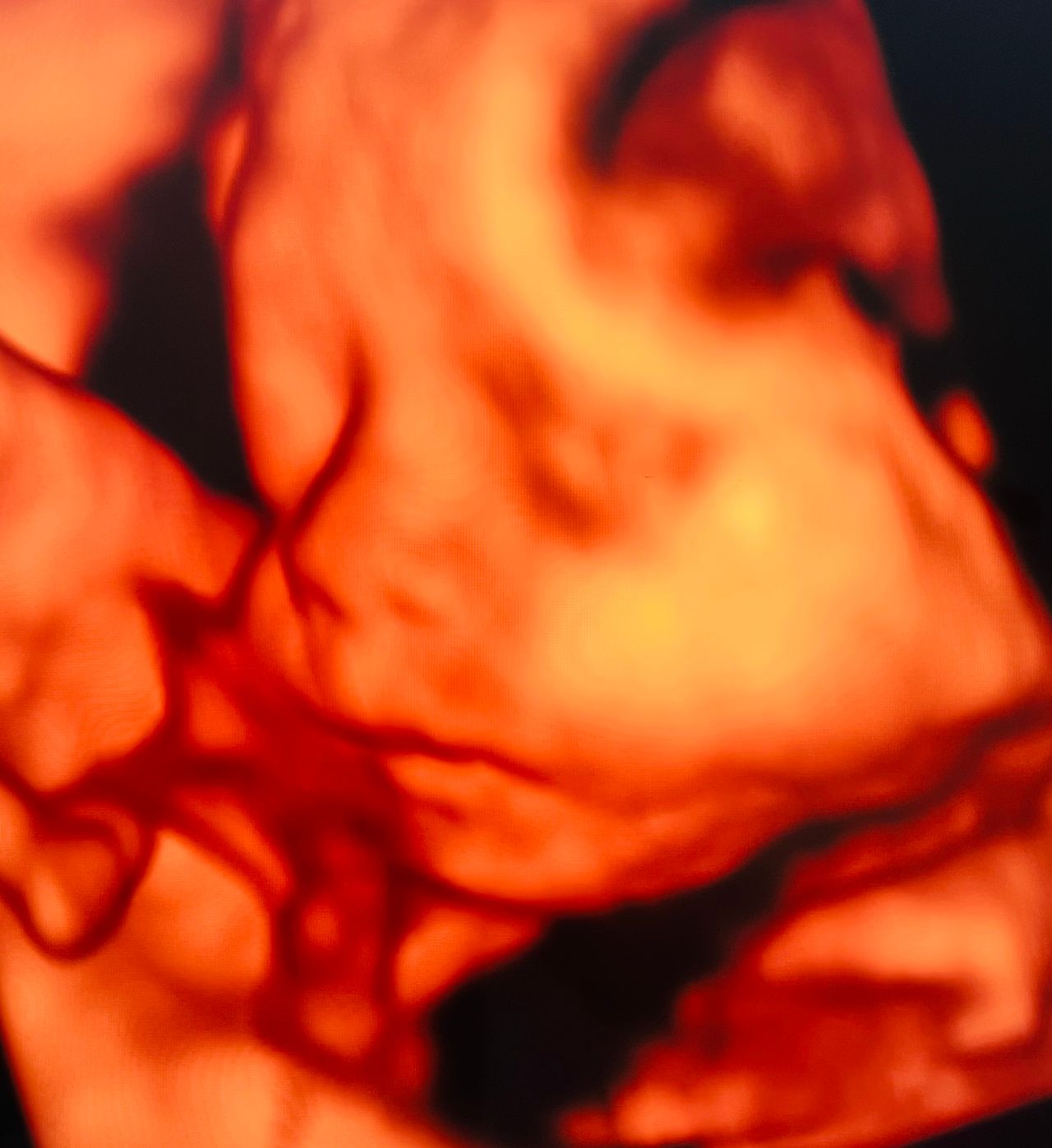 Benjamín Isai Molina Solís-9