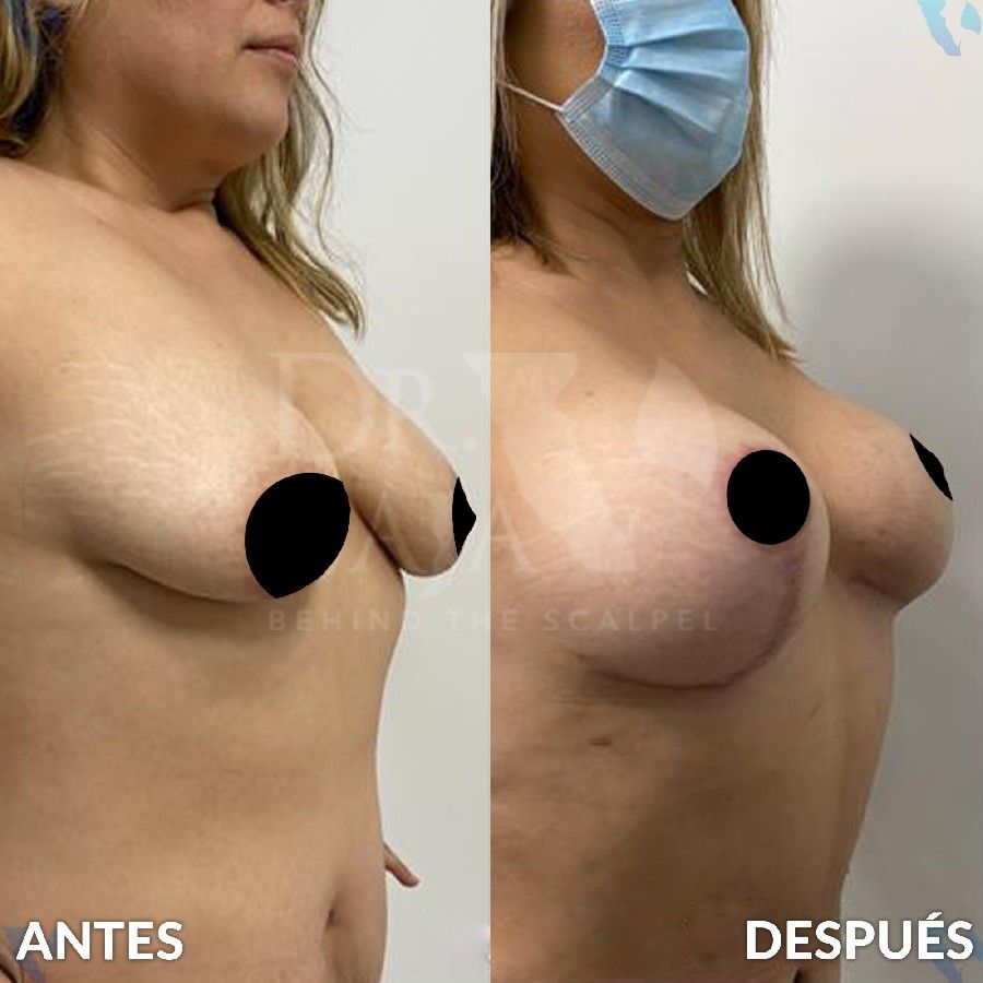 Renato Rodríguez Hirales-6