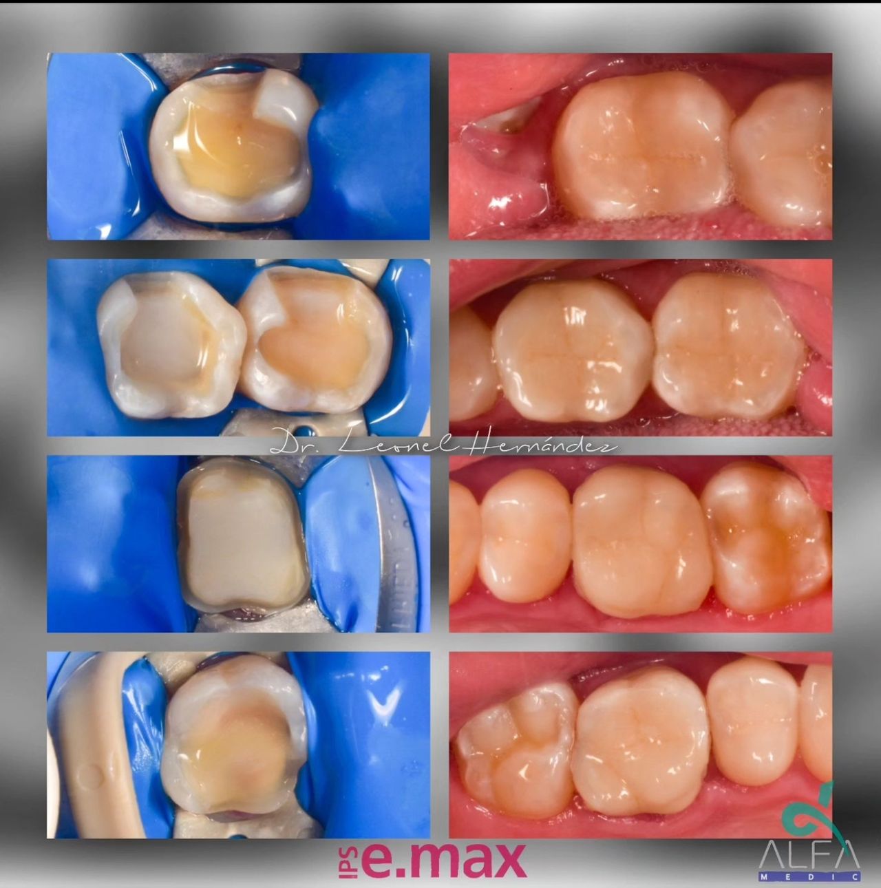 Leonel Hernández Gómez-13