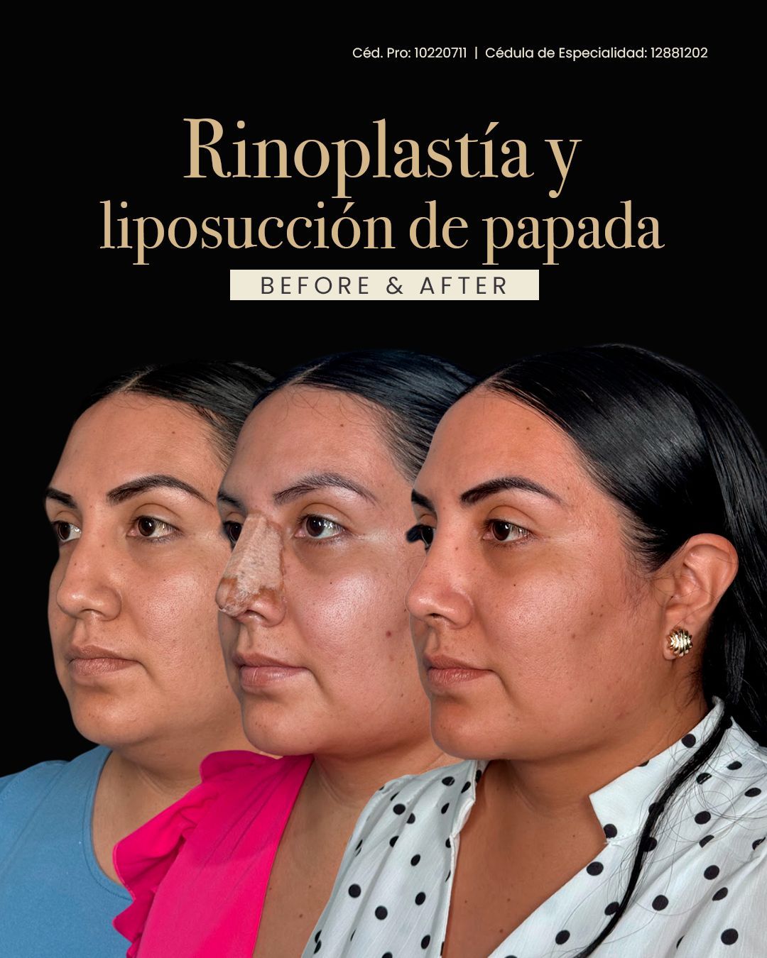 Ingrid Karely Chi-17