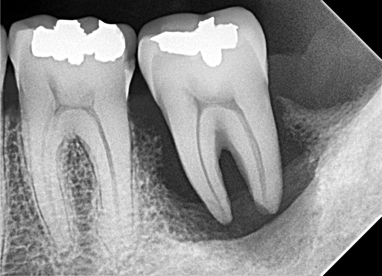 Jair Contreras García-17