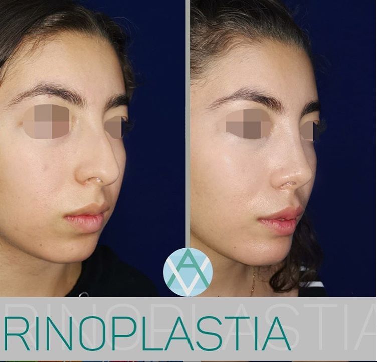 Alfonso Villaseñor Herrero-21