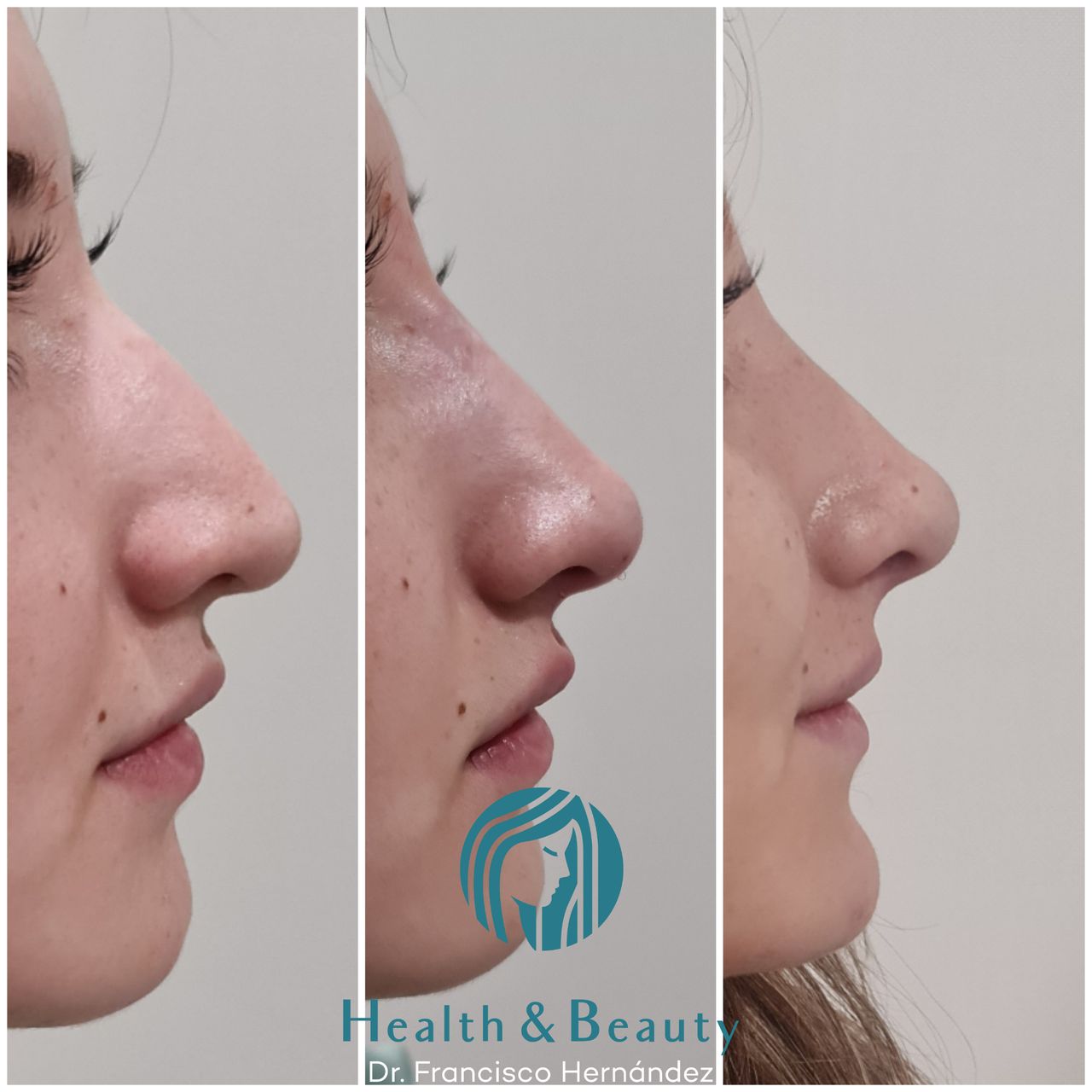 Francisco Hernández Gómez Crespo-98